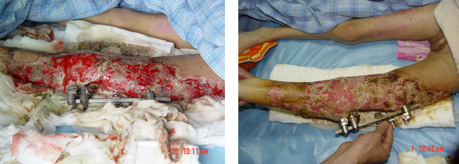 恒峰g22(国际)官网入口-每天有惊喜