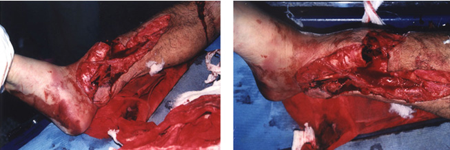 恒峰g22(国际)官网入口-每天有惊喜