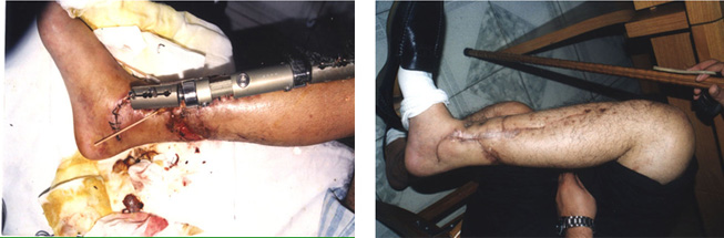 恒峰g22(国际)官网入口-每天有惊喜