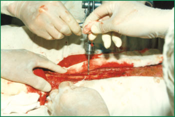 恒峰g22(国际)官网入口-每天有惊喜