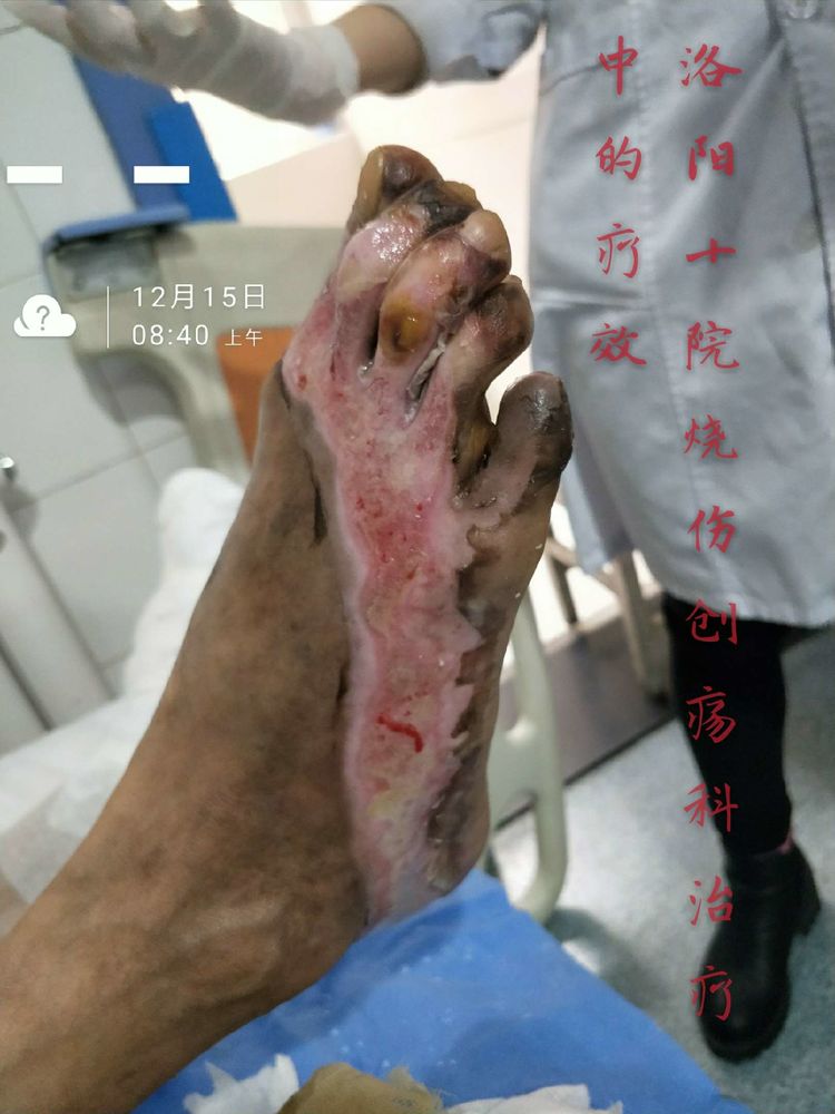 恒峰g22(国际)官网入口-每天有惊喜