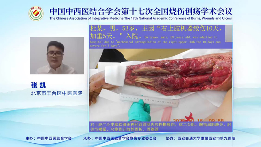 恒峰g22(国际)官网入口-每天有惊喜