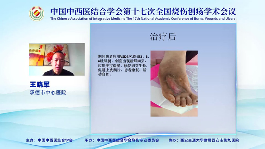 恒峰g22(国际)官网入口-每天有惊喜