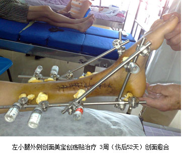 恒峰g22(国际)官网入口-每天有惊喜