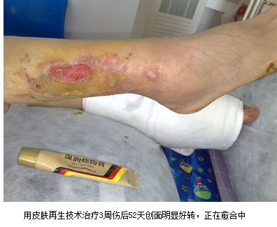 恒峰g22(国际)官网入口-每天有惊喜