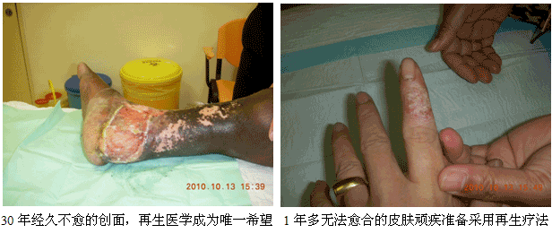 201011181352333628