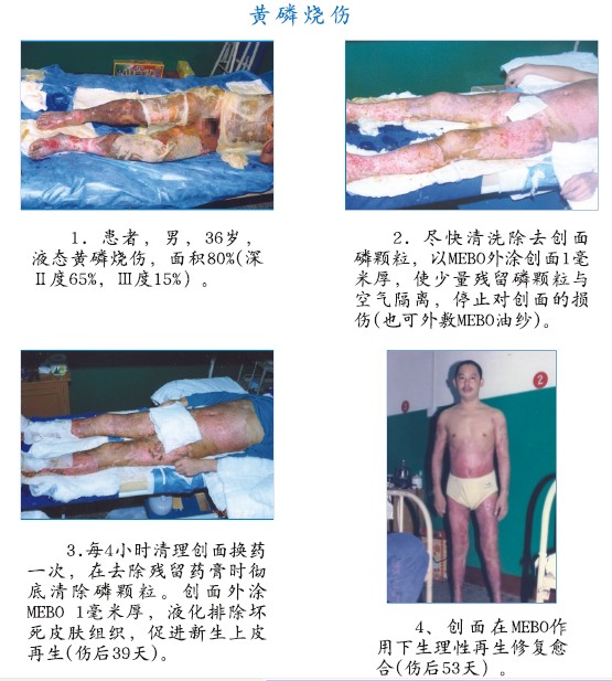 恒峰g22(国际)官网入口-每天有惊喜