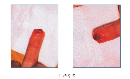 恒峰g22(国际)官网入口-每天有惊喜