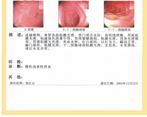 201122014425423